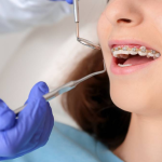 Dentist vs. Orthodontist – Understanding The Difference