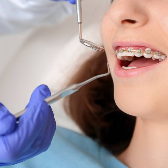 Dentist vs. Orthodontist - Understanding The Difference
