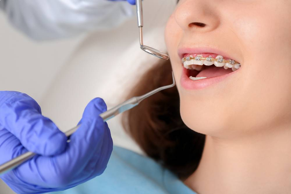 Dentist vs. Orthodontist – Understanding The Difference